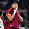 Juventus-Roma, Dovbyk non recupera in tempo